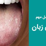 سفیدی زبان چه علل و عواملی دارد و نشان از چه بیماری است ؟