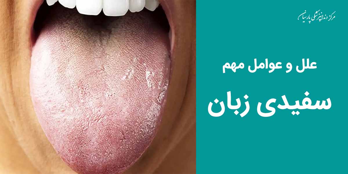 سفیدی زبان چه علل و عواملی دارد و نشان از چه بیماری است ؟
