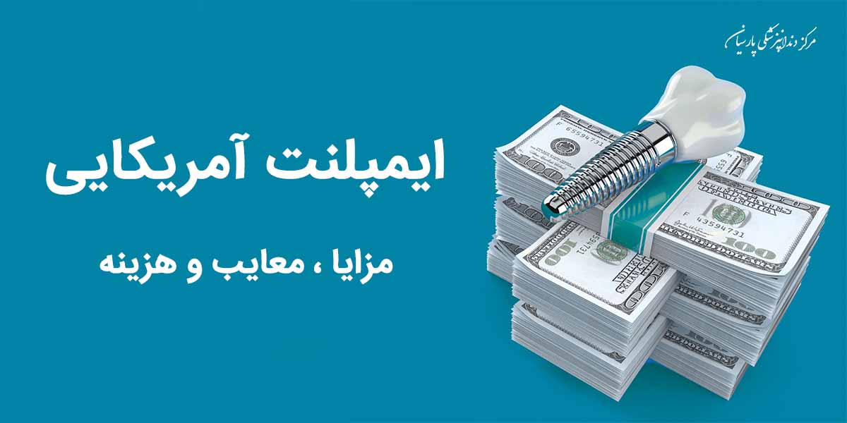 همه چیز در رابطه با قیمت ، هزینه ، مزایا و معایب ایمپلنت آمریکایی