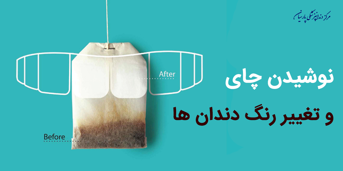 نوشیدن چای چه تاثیری بر تغییر رنگ دندان دارد ؟