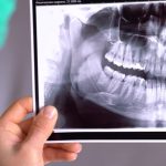 همه چیز در رابطه با استفاده از عکس بایت وینگ که لازم است بدانید