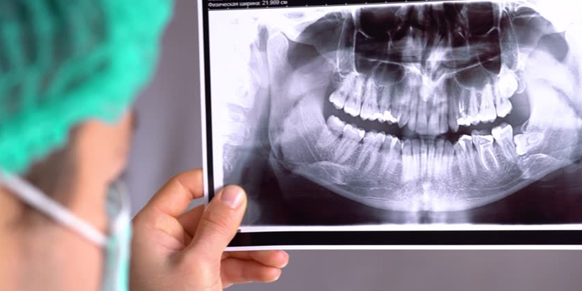 همه چیز در رابطه با استفاده از عکس بایت وینگ که لازم است بدانید