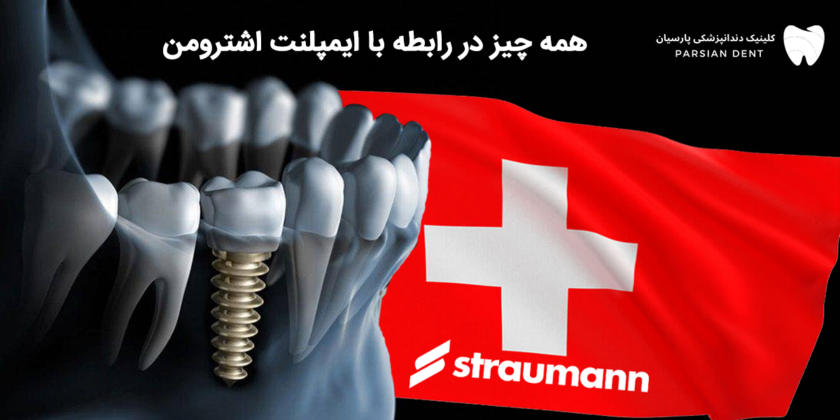 همه چیز در رابطه با ایمپلنت اشترومن که باید بدانید