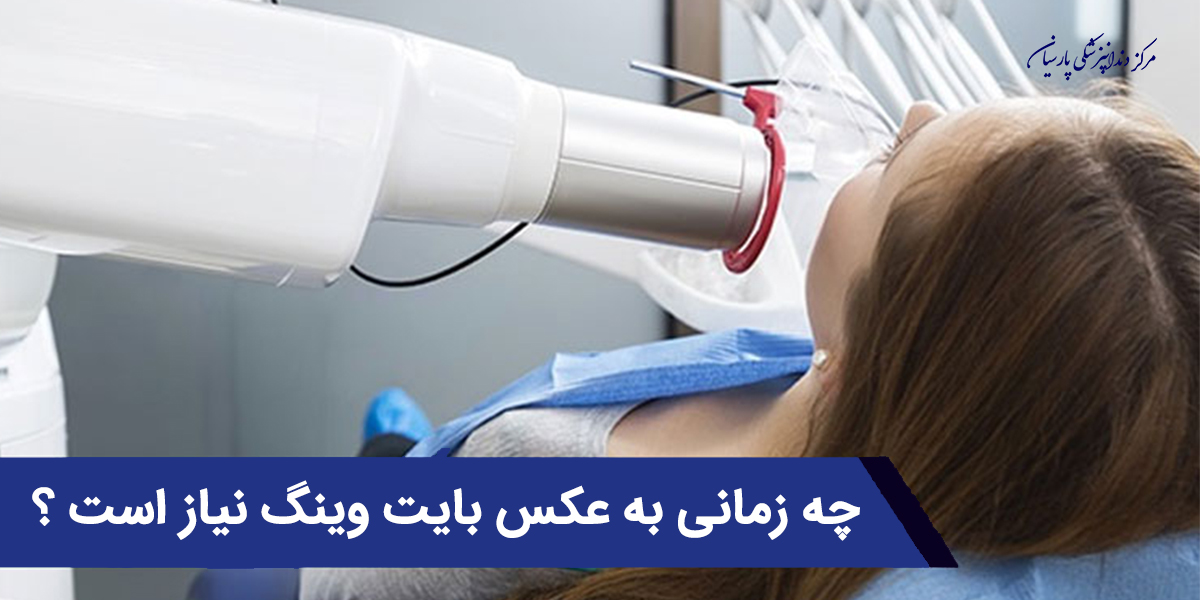 چه زمانی به عکس بایت وینگ نیاز است ؟