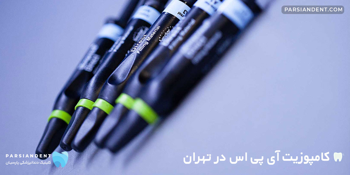 کامپوزیت آی پی اس در تهران