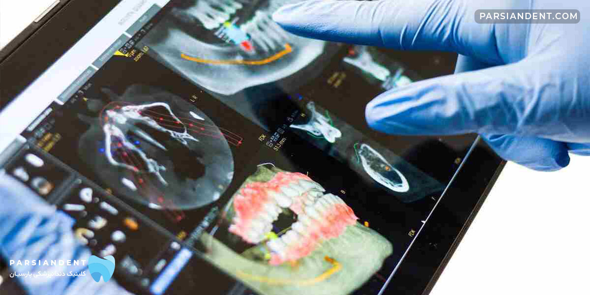 ایمپلنت دیجیتال پاسداران