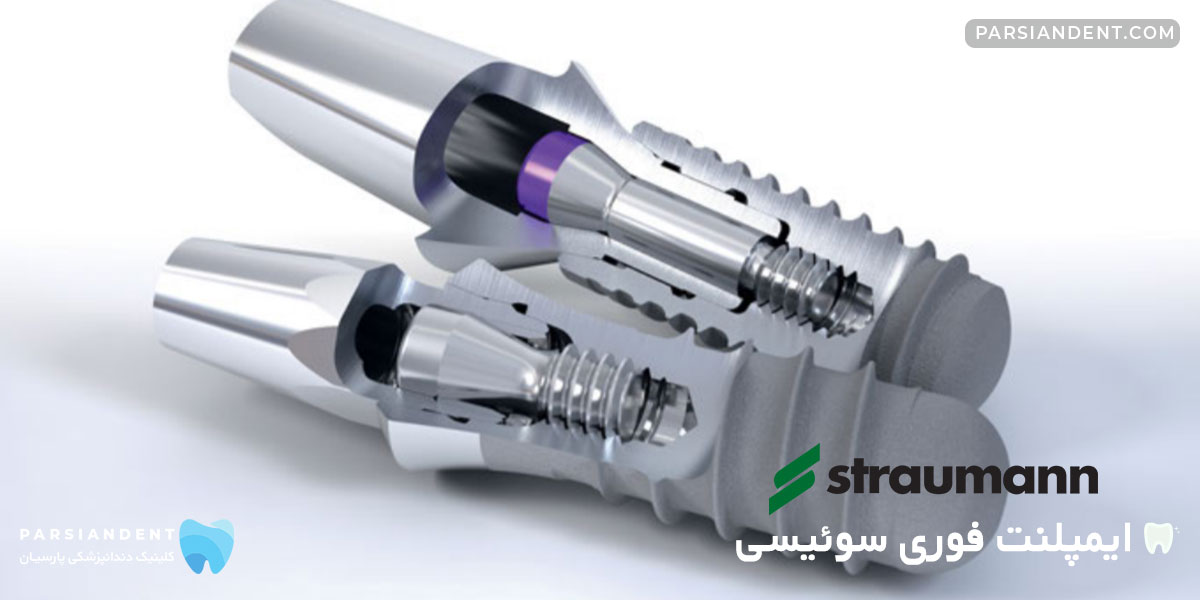 ایمپلنت فوری سوئیسی اشترومن