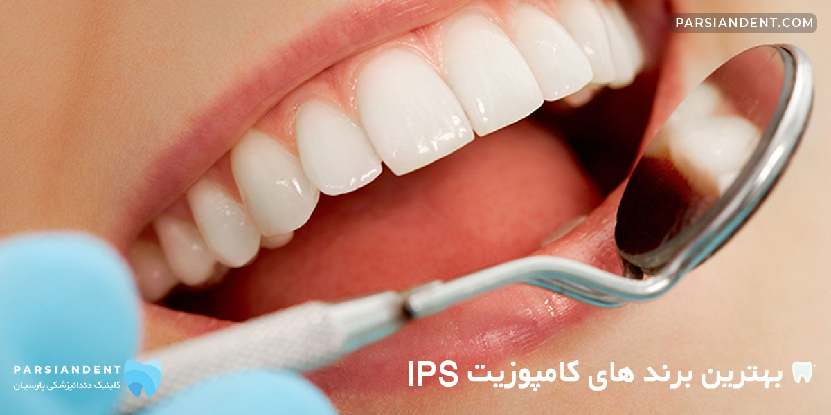 بهترین برند های کامپوزیت IPS