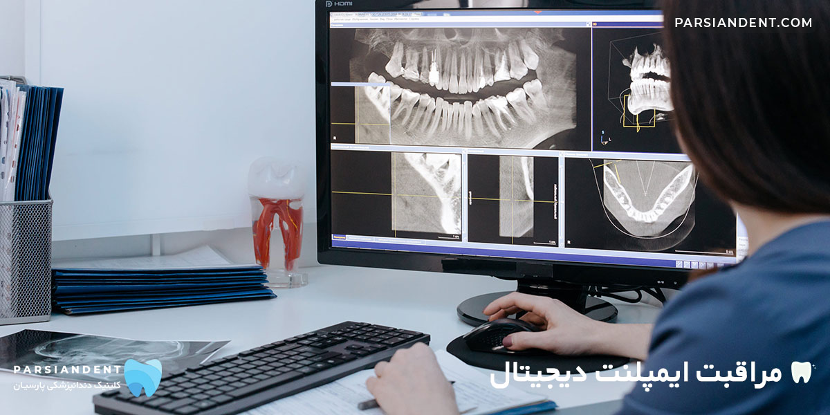 مراقبت ایمپلنت دیجیتال