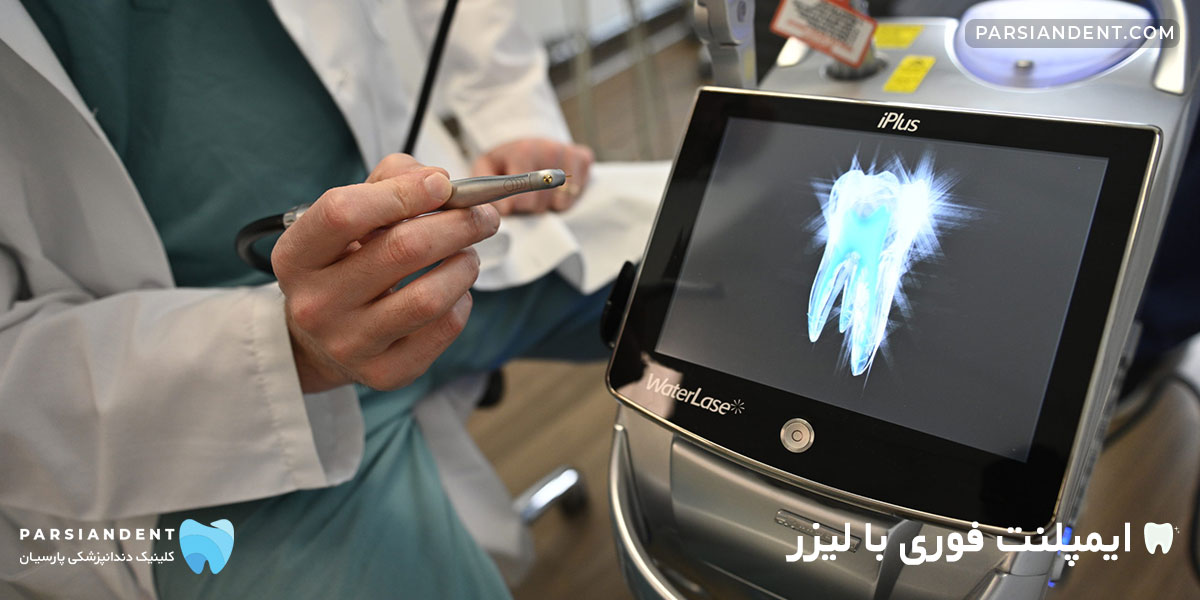 ایمپلنت فوری با لیزر
