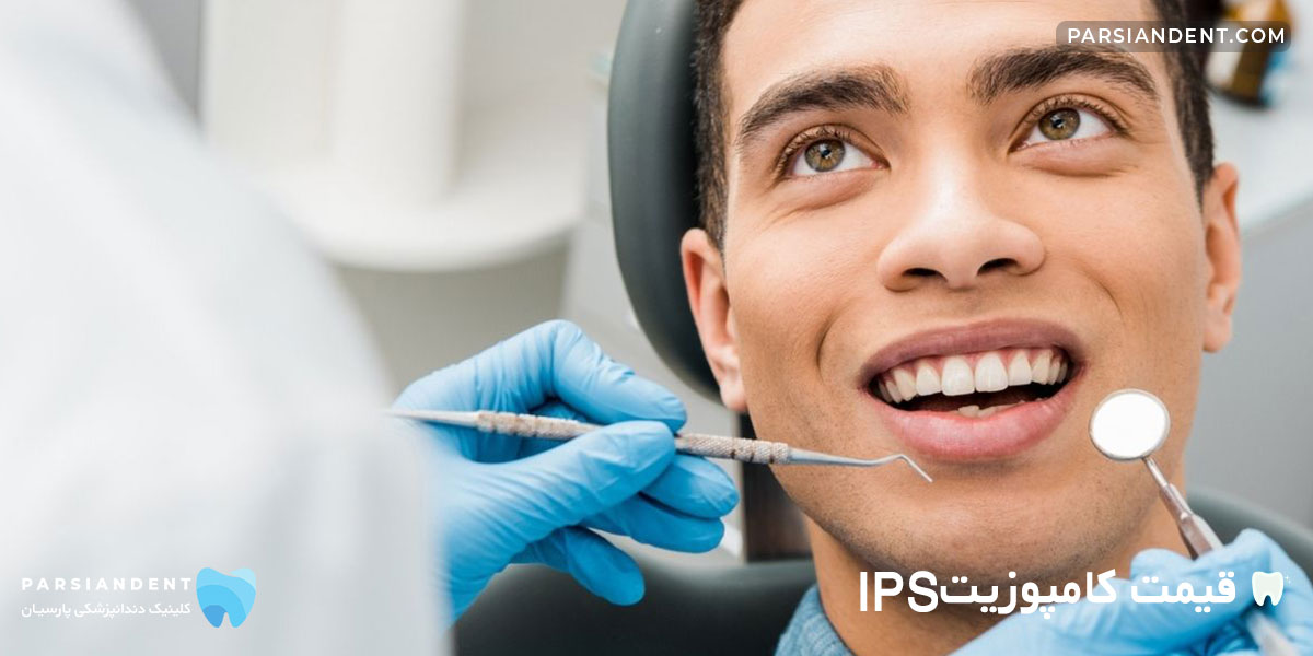 قیمت کامپوزیت IPS
