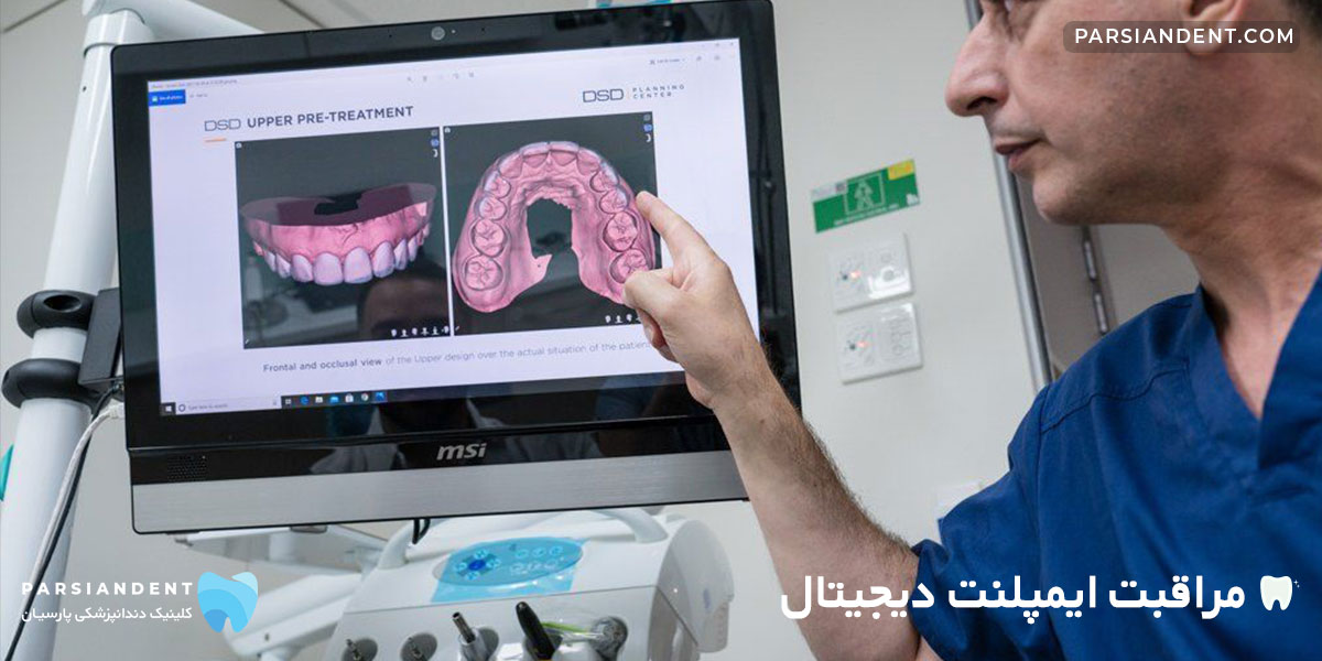 مراقبت ایمپلنت دیجیتال