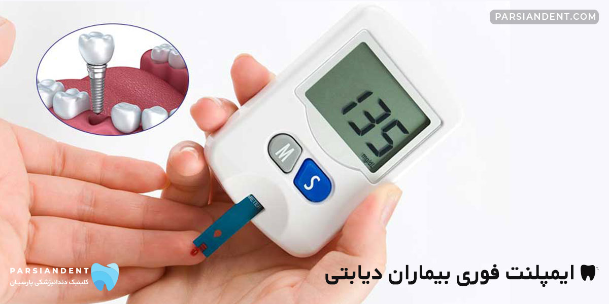 ایمپلنت فوری بیماران دیابتی