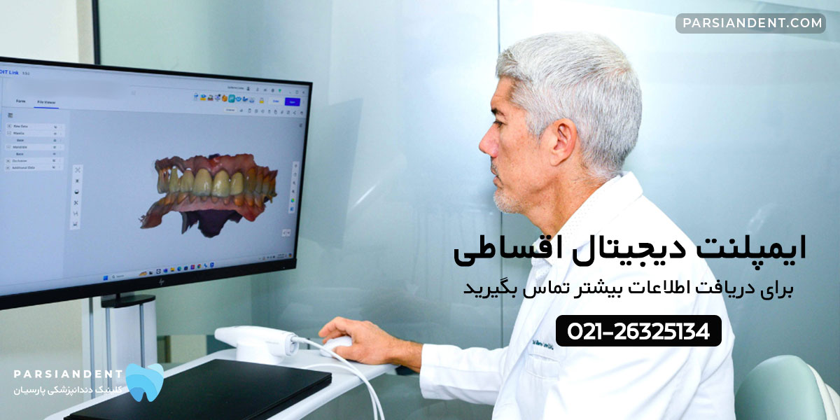ایمپلنت دیجیتال اقساطی شرق تهران