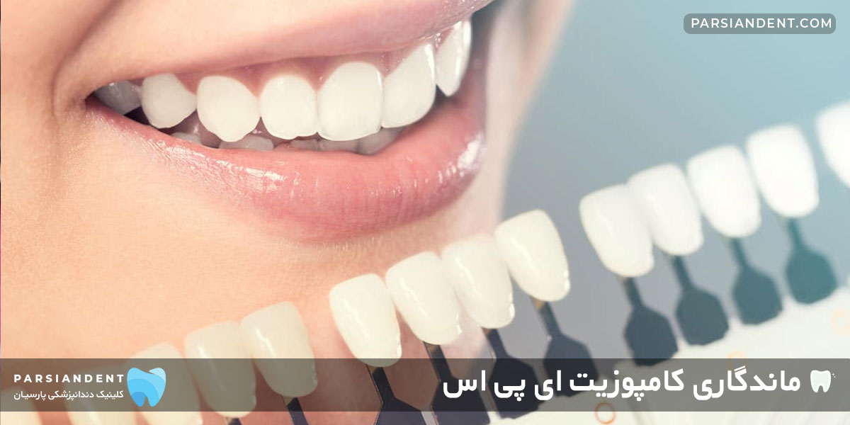 بالا بردن طول عمر کامپوزیت ای پی اس