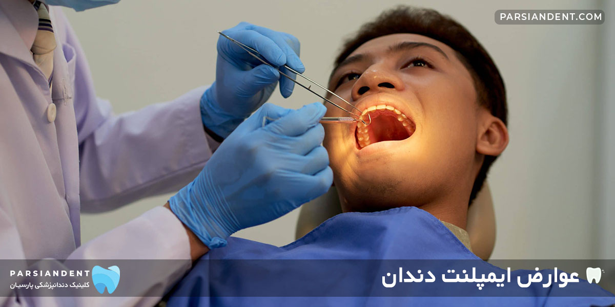 پیشگیری از بروز عوارض ایمپلنت دندان