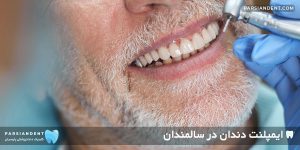ایمپلنت دندان در سالمندان