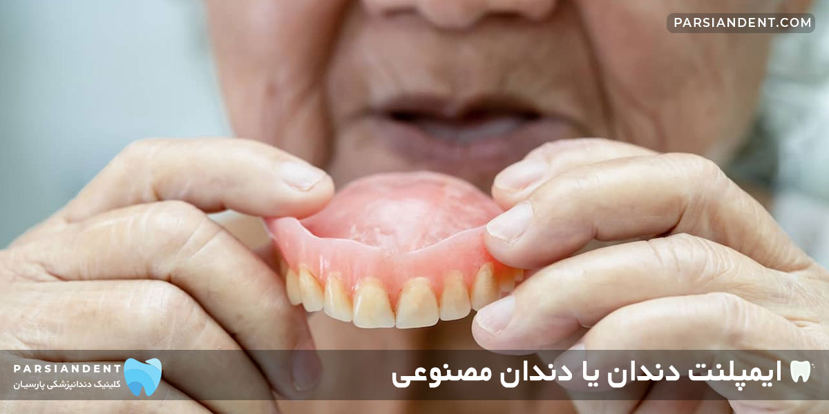 دندان مصنوعی