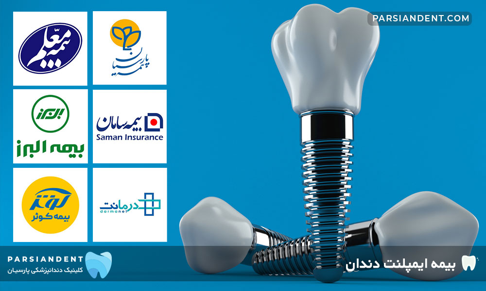 بیمه ایمپلنت دندان