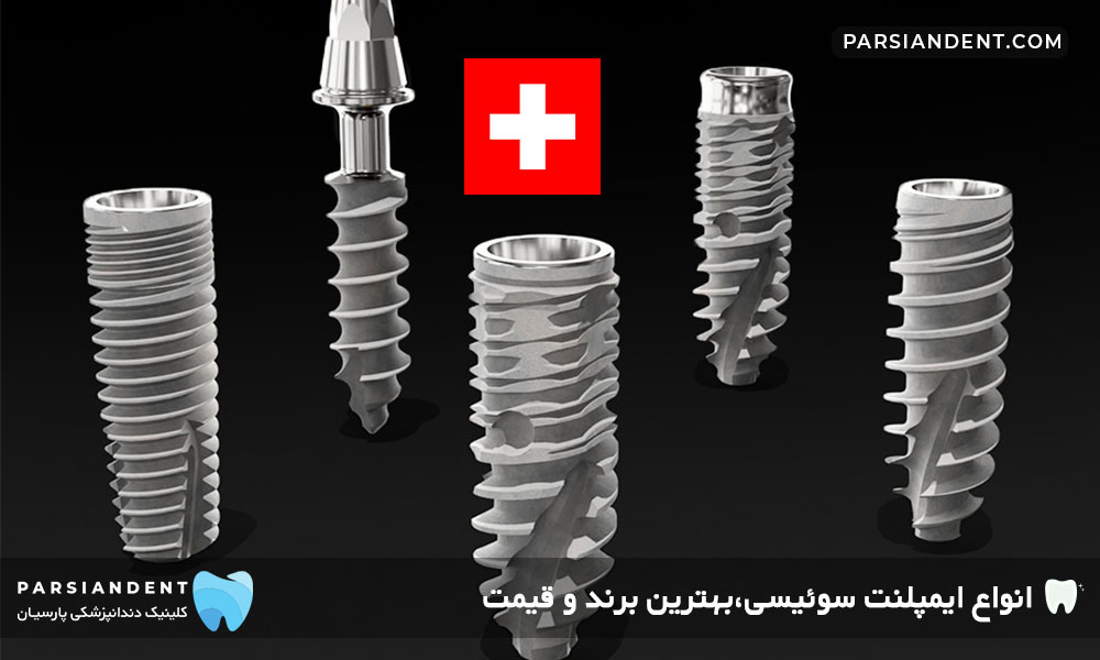 ایمپلنت سوئیسی