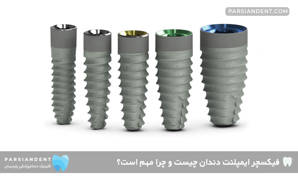 فیکسچر ایمپلنت دندان چیست و چرا مهم است؟