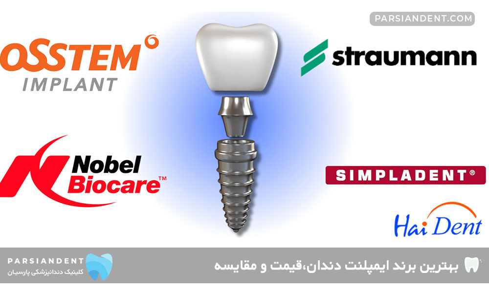 بهترین برند ایمپلنت دندان