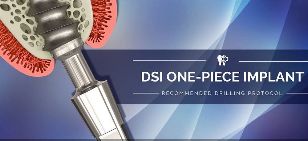 قیمت ایمپلنت دندان یک تکه