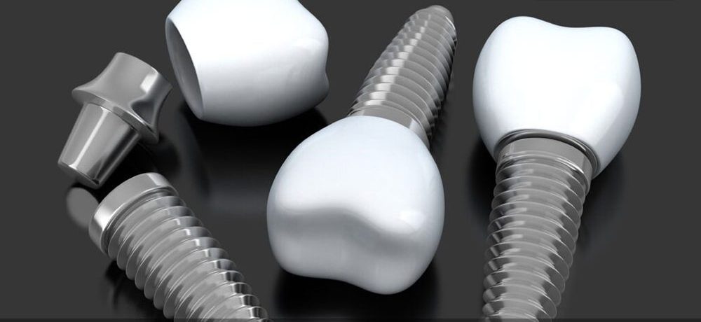 ایمپلنت دندان یک تکه (one pice)