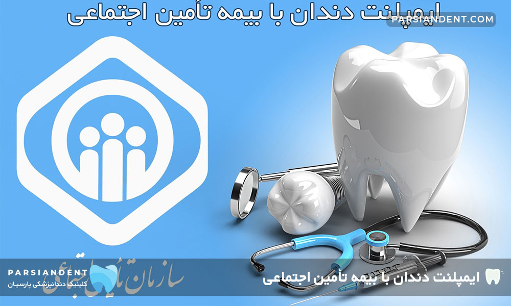 ایمپلنت دندان با بیمه تأمین اجتماعی