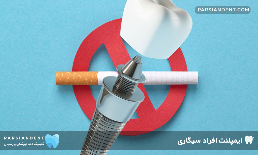 ایمپلنت افراد سیگاری