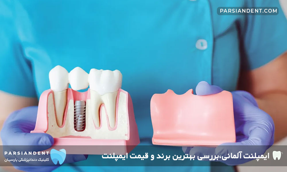 بهترین برند ایمپلنت آلمانی