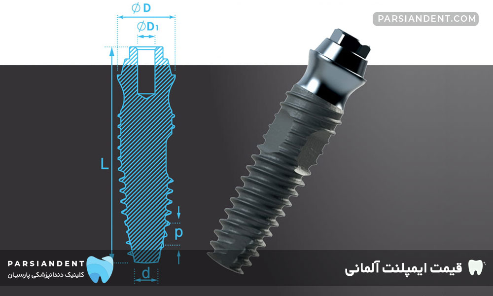 قیمت ایمپلنت آلمانی