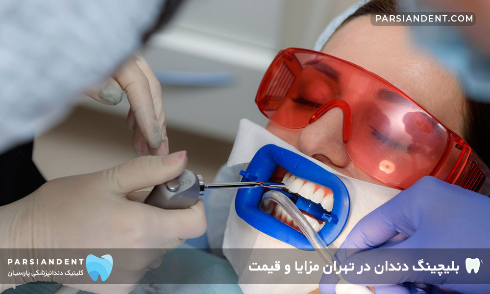 قیمت بلیچینگ دندان