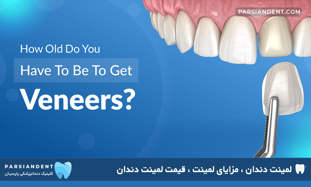 قیمت لمینت دندان