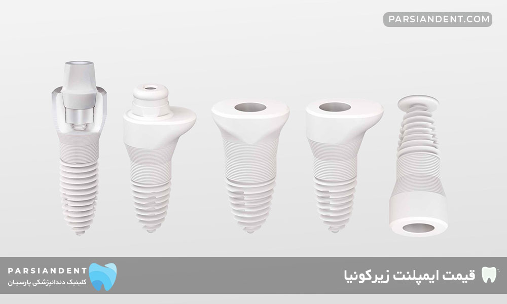 مزایا ایمپلنت زیرکونیا
