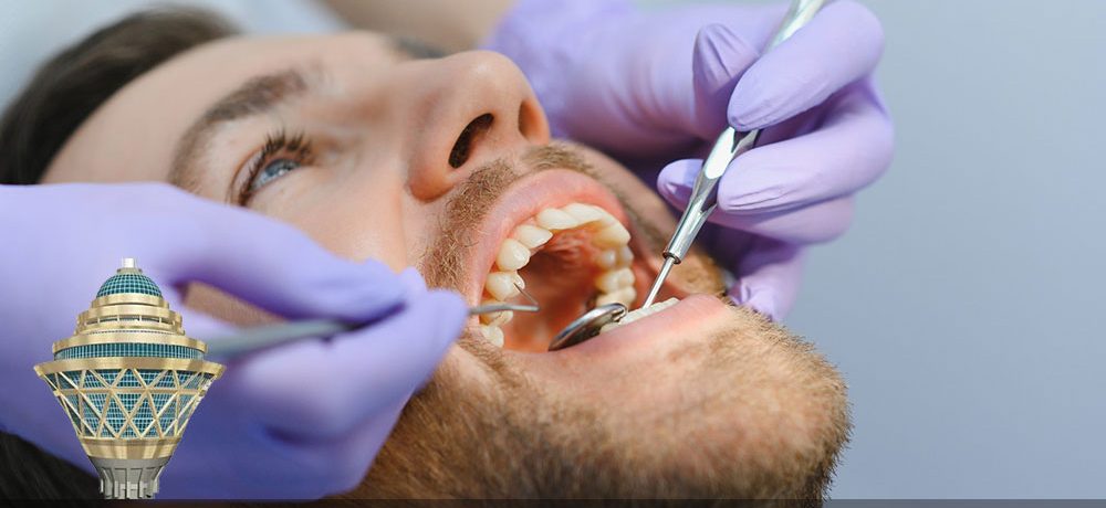 مزایای ایمپلنت دندان اقساطی