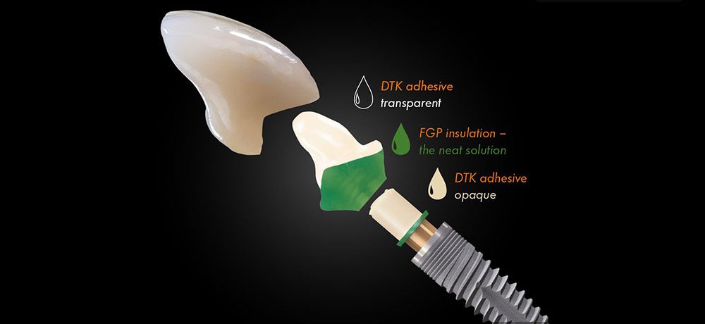 قیمت چسب ایمپلنت دندان