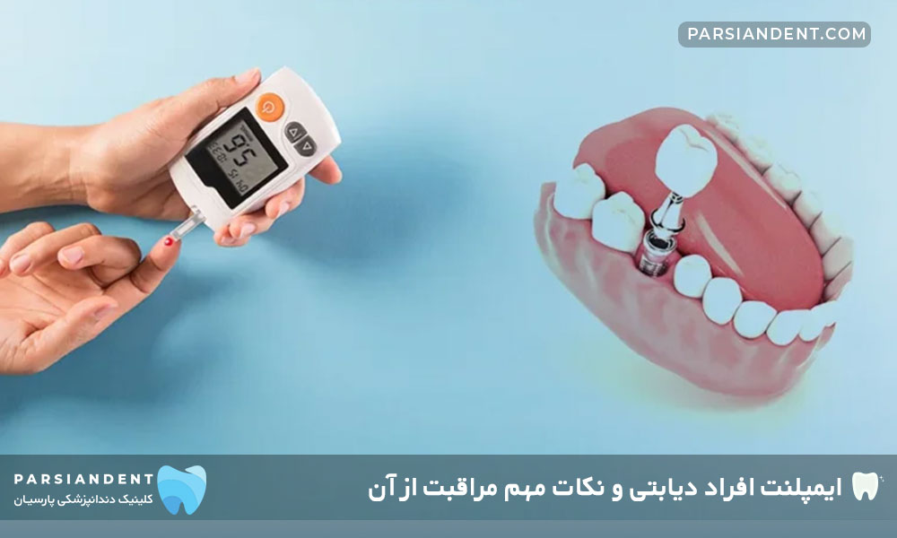 ایمپلنت افراد دیابتی و نکات مهم مراقبت از آن