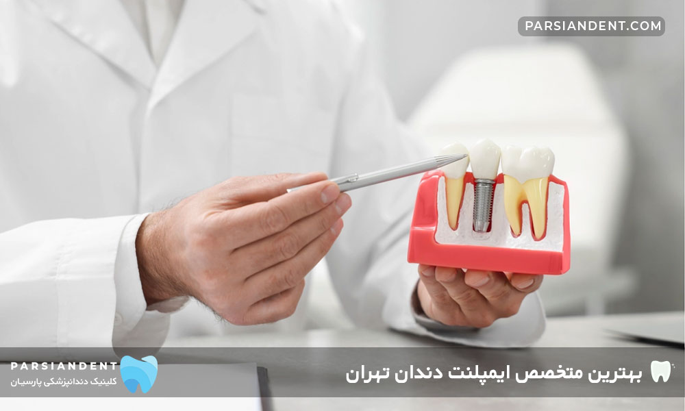 بهترین متخصص ایمپلنت دندان تهران