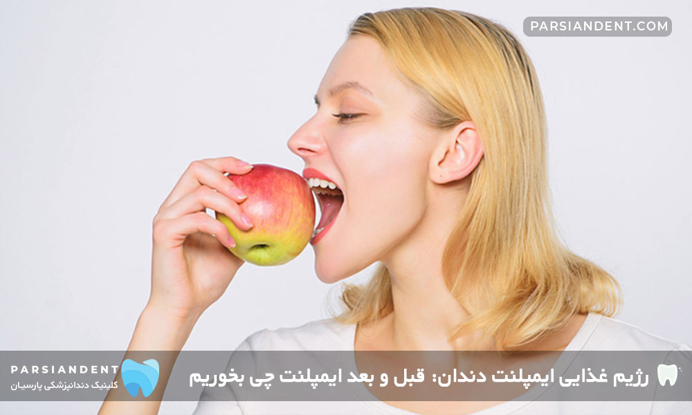 رژیم غذایی ایمپلنت