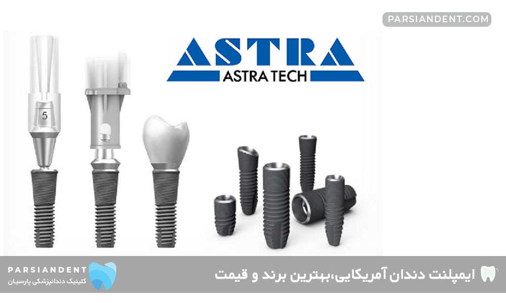 ایمپلنت آسترا تک (Astra Tech)