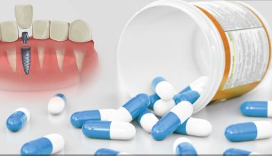 داروهای ایمپلنت دندان