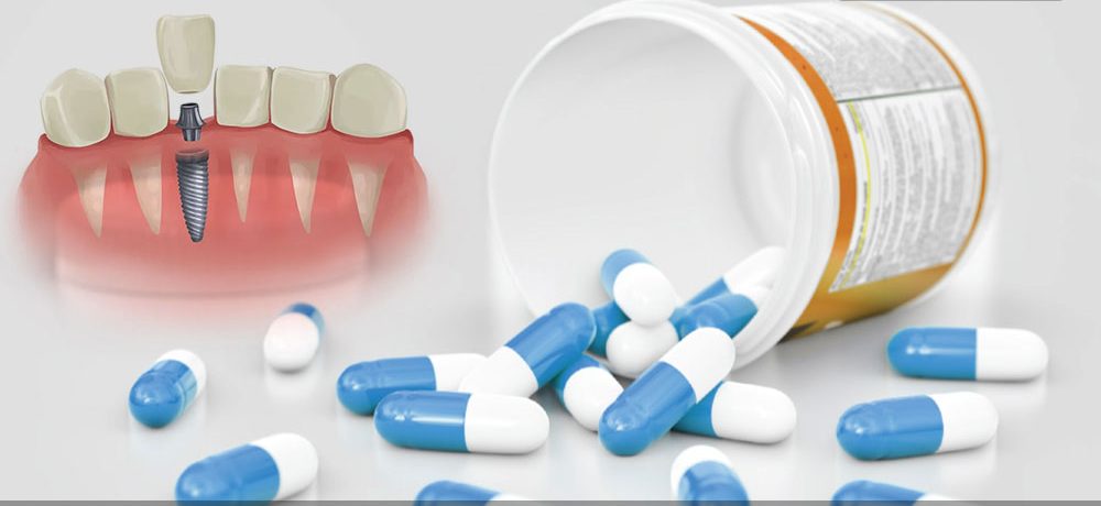 داروهای ایمپلنت دندان