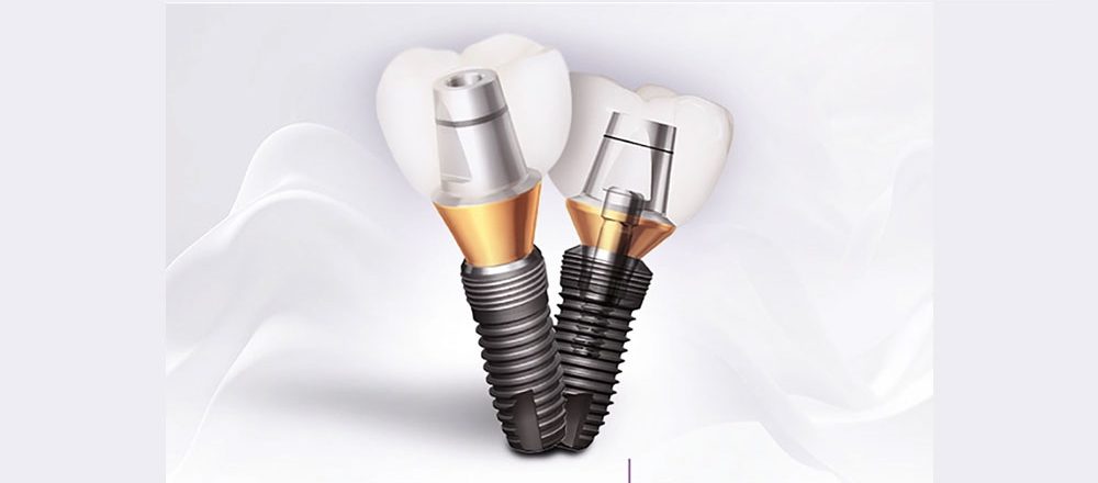 قیمت ایمپلنت کره ای Implantium