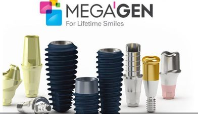 قیمت ایمپلنت کره ای