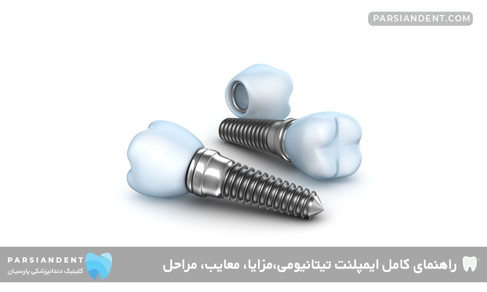 ایمپلنت تیتانیومی چیست؟